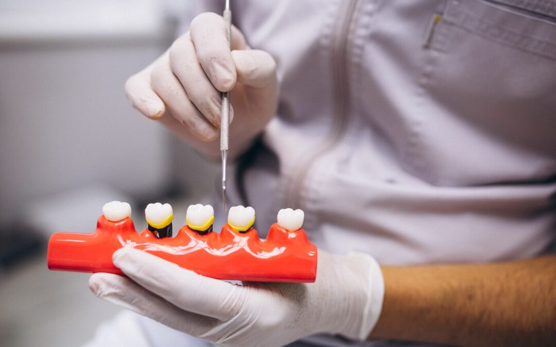 The Role of Dental Crowns and Bridges in Restoring Your Smile