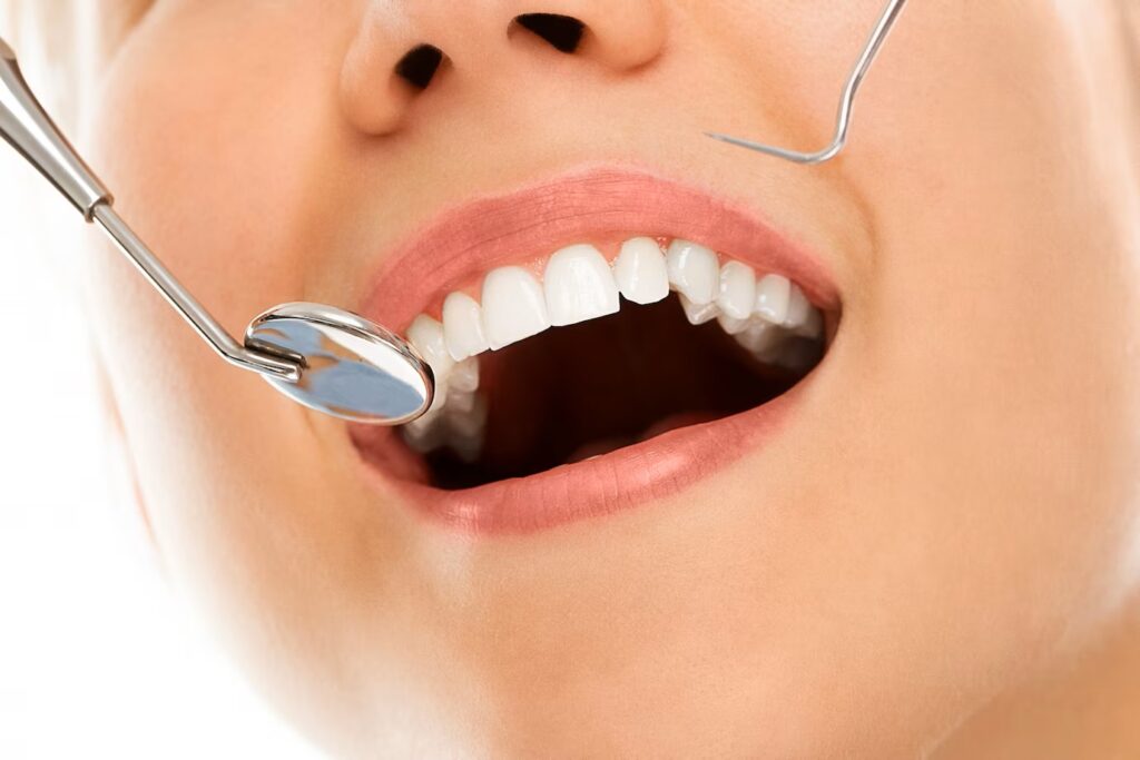 dentist smile tooth contouring reshaping tools