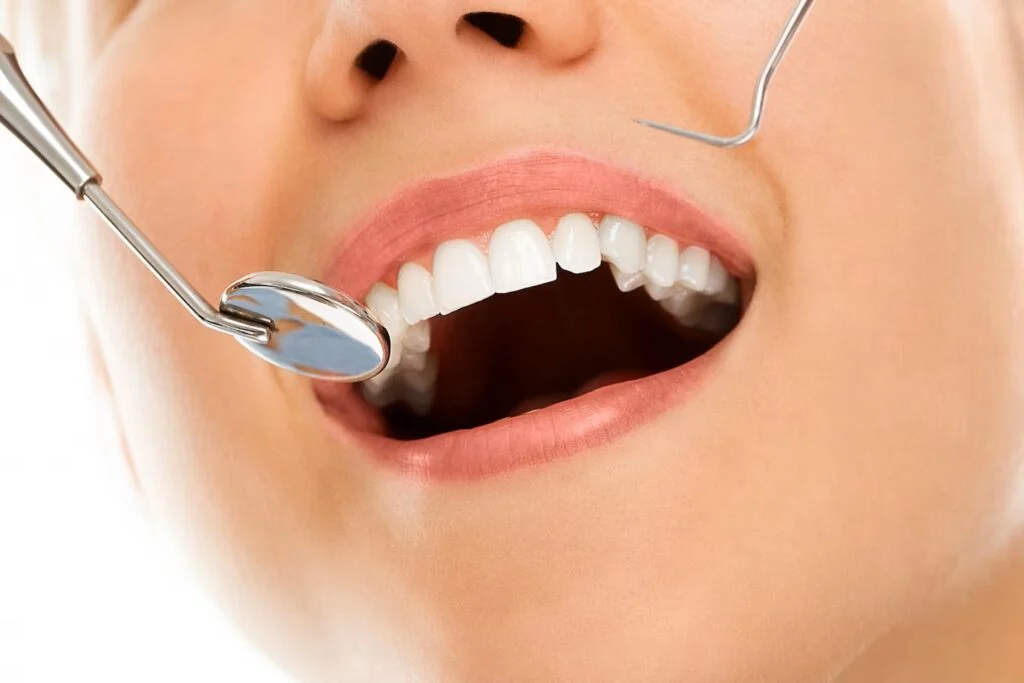 Dental Cosmetics to Boost Confident Smiles: Benefits of Tooth Contouring and Reshaping
