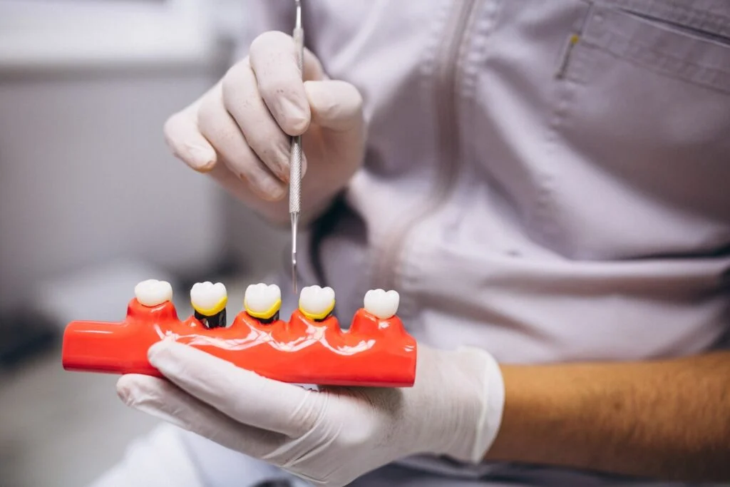 The Role of Dental Crowns and Bridges in Restoring Your Smile